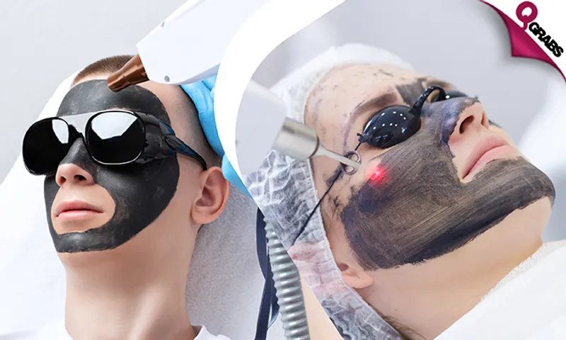 Carbon Laser + Bleaching at United Care Medical Center!